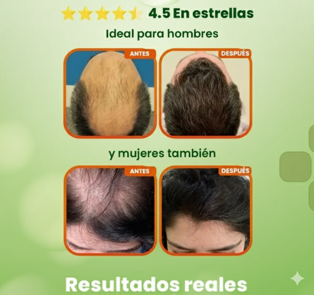 BATANA OIL-Crecimiento del cabello