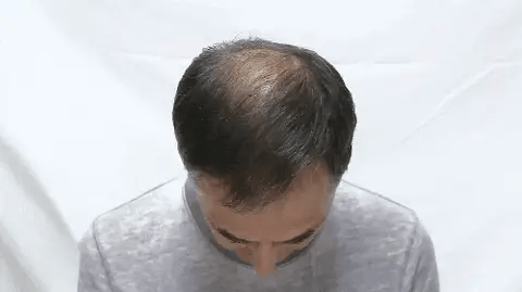 Toppik ® 💇‍♂️✨ Retoma tu confianza