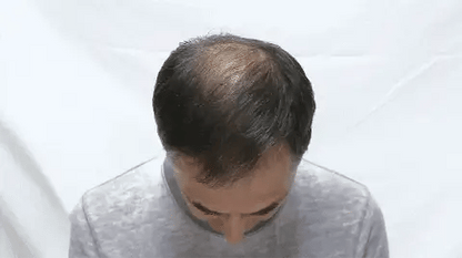 Toppik ® 💇‍♂️✨ Retoma tu confianza